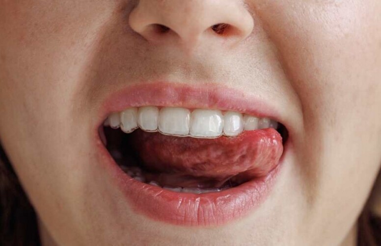 牙黃原因是什麼？牙齒黃刷得掉嗎？牙齒什麼顏色最健康？