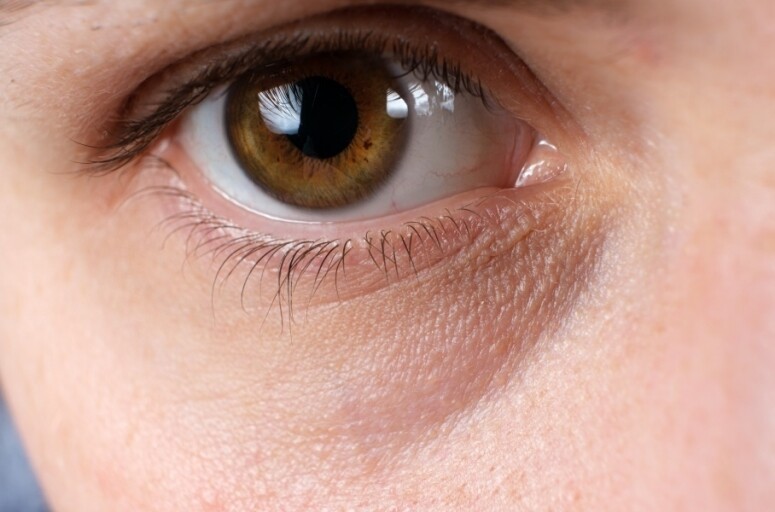 眼霜用法！搽錯手法眼紋越多？眼霜要每天擦？挑選眼霜重點是什麼？