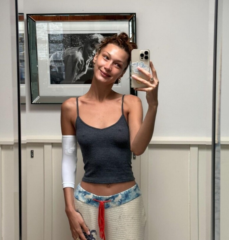 Bella Hadid 發生了甚麼事,因萊姆病而消失,這個症有多可怕? Bella Hadid 發生了甚麼事,因萊姆病而消失,這個症有多可怕?