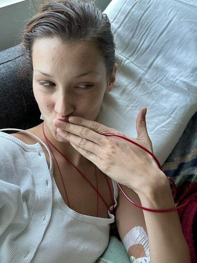 Bella Hadid 發生了甚麼事,因萊姆病而消失,這個症有多可怕? Bella Hadid 發生了甚麼事,因萊姆病而消失,這個症有多可怕?
